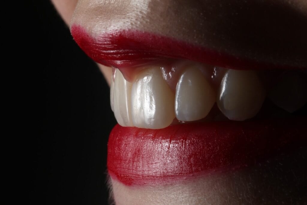 Dental implant treatment planning